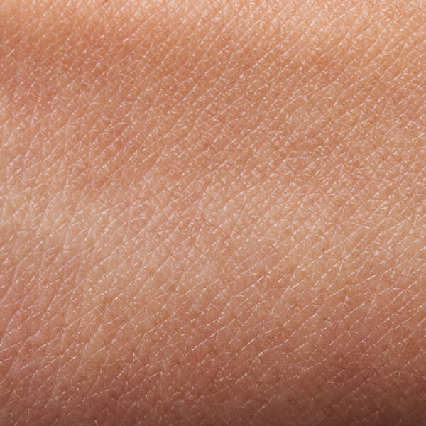 17-The skin-your largest organ